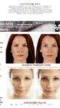 Mobile Screenshot of juvedermnyc.org